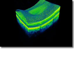 3D Scan of an eye