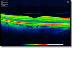 3D OCT Line Scan of an eye